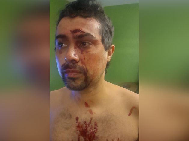 Brazilian student living in Limerick beaten with ‘bat’ in racially-motivated attack