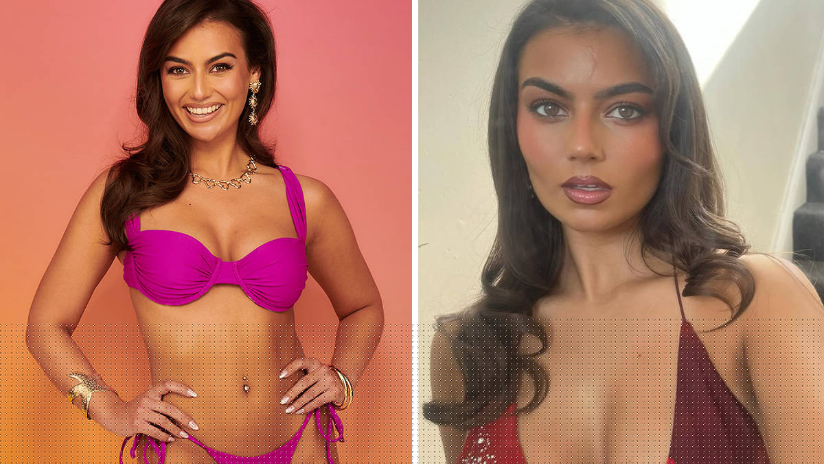 How did Love Island's Megan Forte Clarke get the scar on her head?