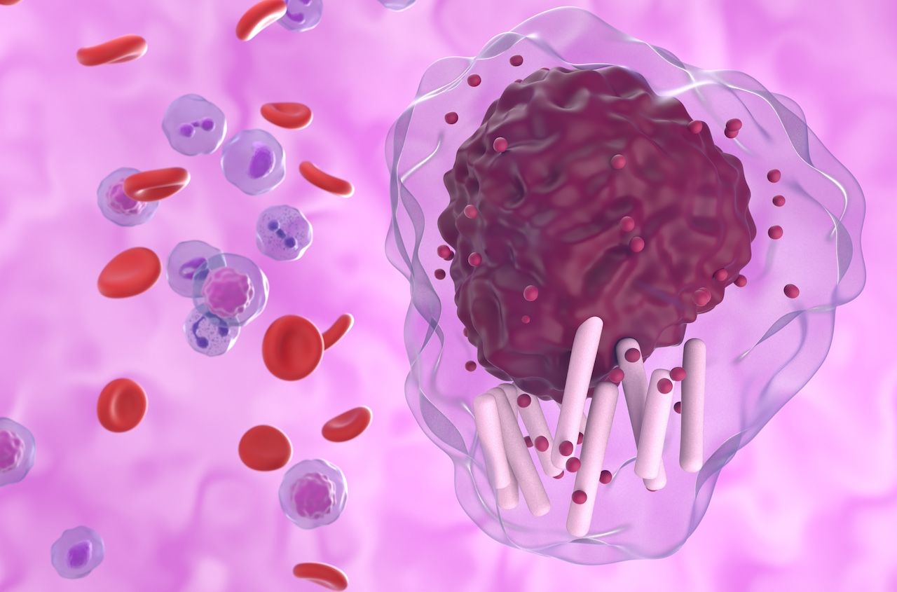 COVID-19 Deaths Cloud Interpretation of Acalabrutinib-Venetoclax Combo Results