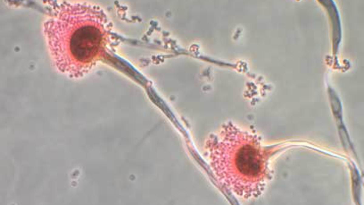 Deadly fungus that 'eats you from the inside out' invades US: 'Hundreds of thousands of lives at risk'