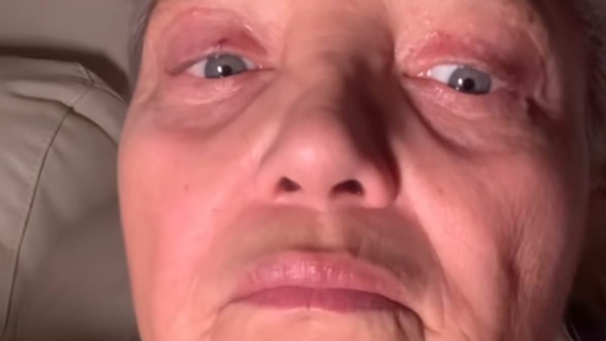 Grandmother unrecognisable after astonishing £10k facelift - results send social media into meltdown: 'Insane transformation!'