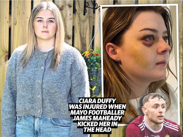‘My GAA star boyfriend kicked me in the face’