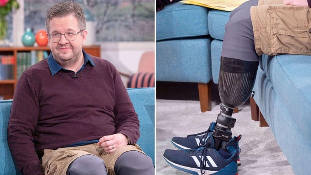 TIL surgeon Neil Hopper has been jailed for insurance fraud and possession of extreme pornography after it was proven he intentionally caused both of his legs to be amputated by submerging his feet in dry ice for 8 hours. He was previously shortlisted to become a para-astronaut and go to space.