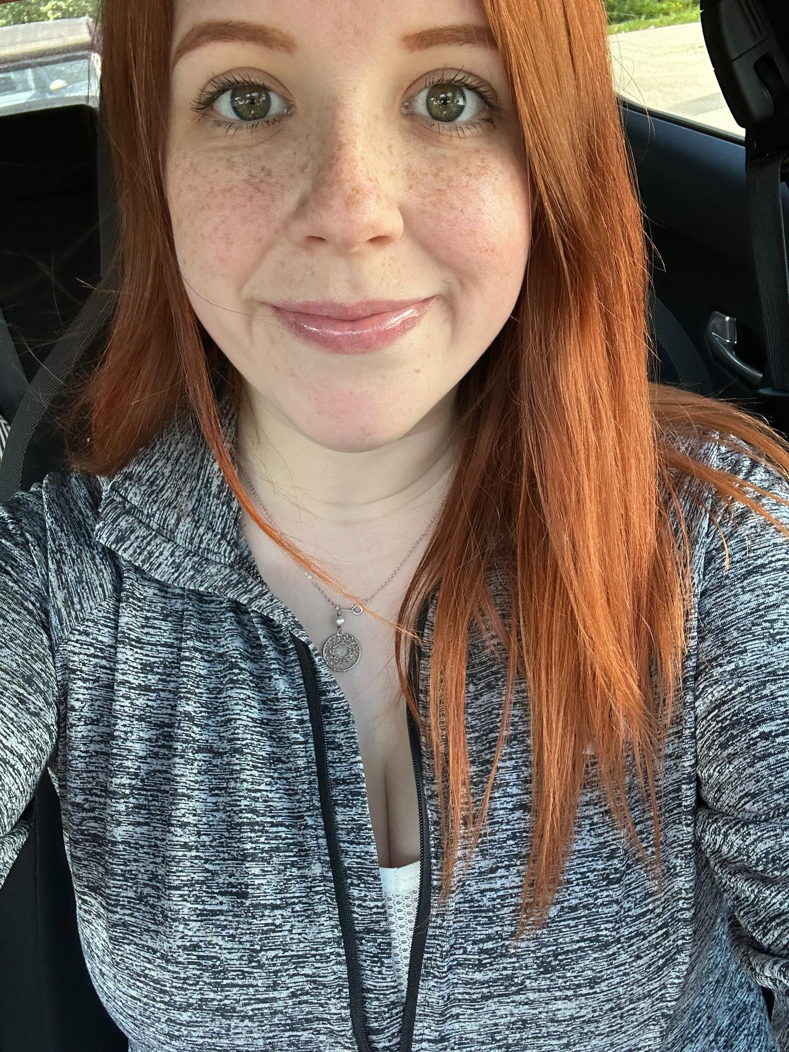 The sun likes leaving marks on me, just like you ;p