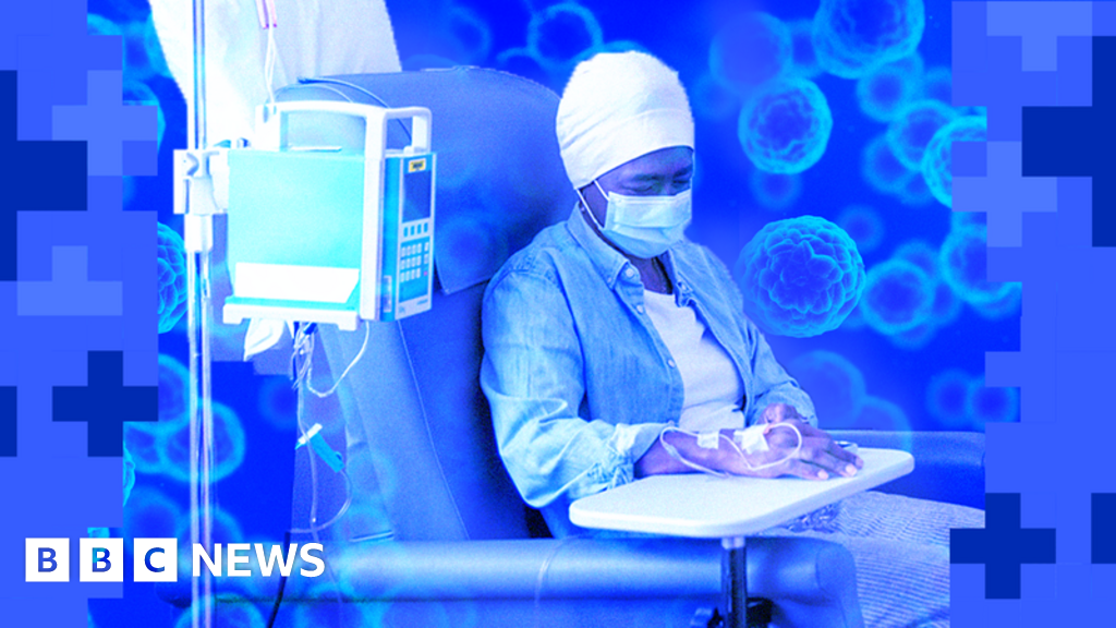 Nearly all NHS trusts are struggling to hit cancer targets - use our tool to check yours