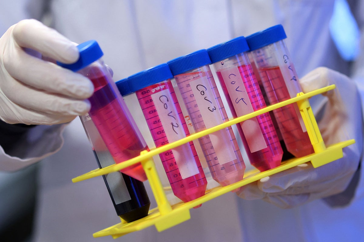 Long Covid could trigger symptoms similar to Alzheimer’s, new study says