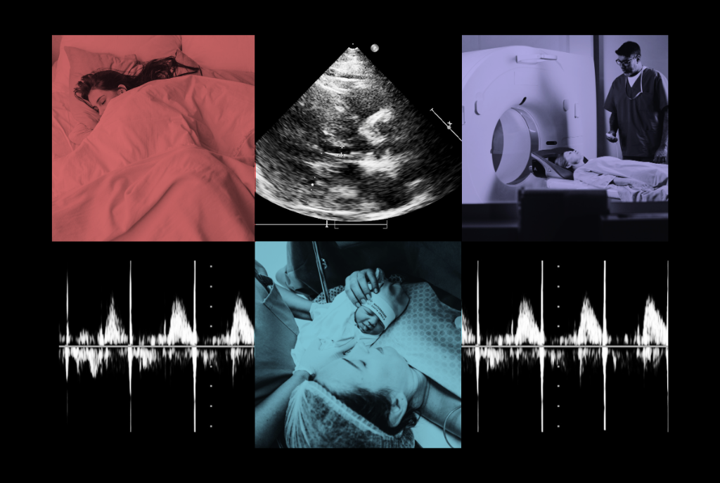 “It felt like a life-or-death choice”: Pregnancy with Long COVID has many unknowns