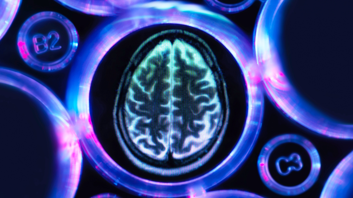 The 4 Rarer Kinds of Dementia Most People Don't Know Exist