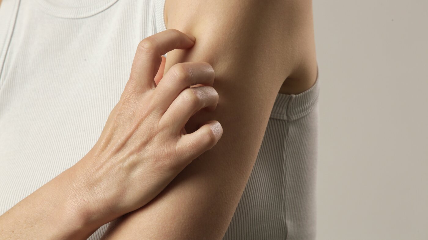 Shingles can hit younger than you think. The vaccine can prevent the painful illness