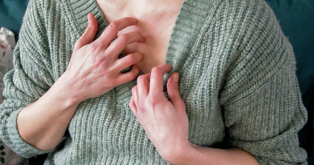 Woman wakes up with mark on chest and people urge 'go to doctors'