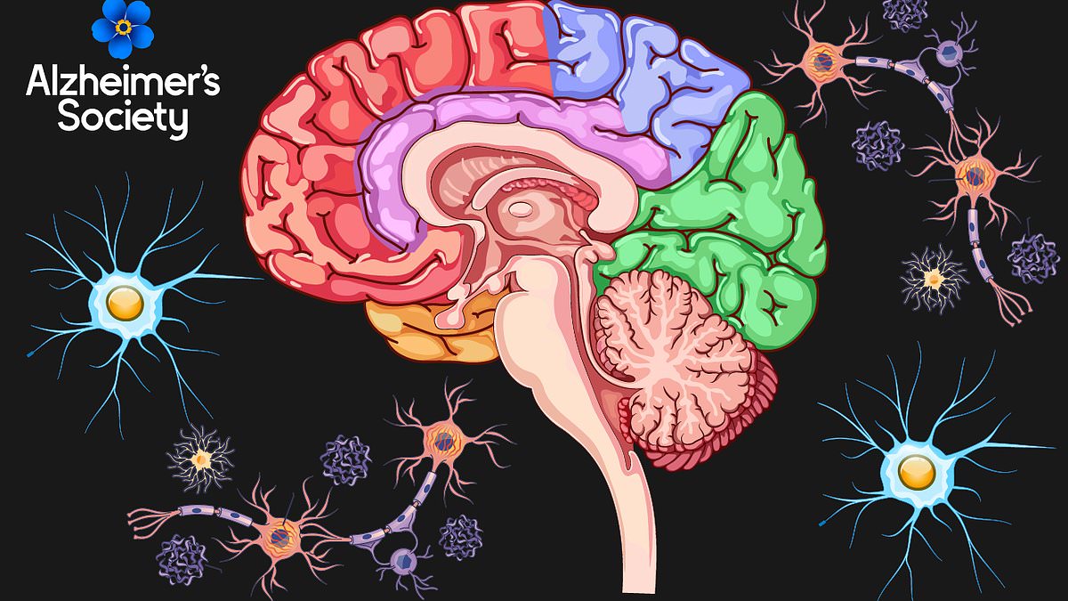 How to spot if someone you love has the early warning signs of dementia: Deep Dive charts as never before how the illness destroys the brain