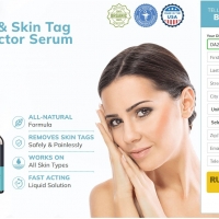 TagFree Skin Tag Remover