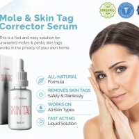 Luxe Seréna Skin Tag Remover